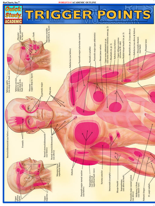 Title details for Trigger Points by BarCharts Publishing, Inc. - Available